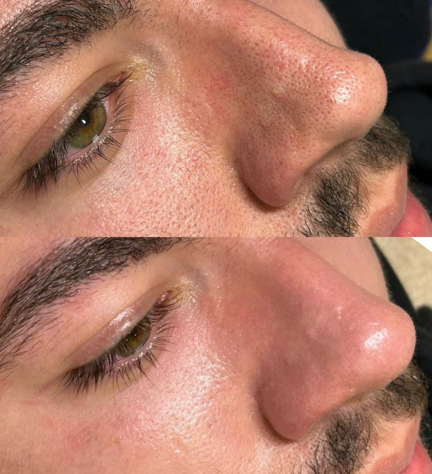 Texture & Pores · House of Highline