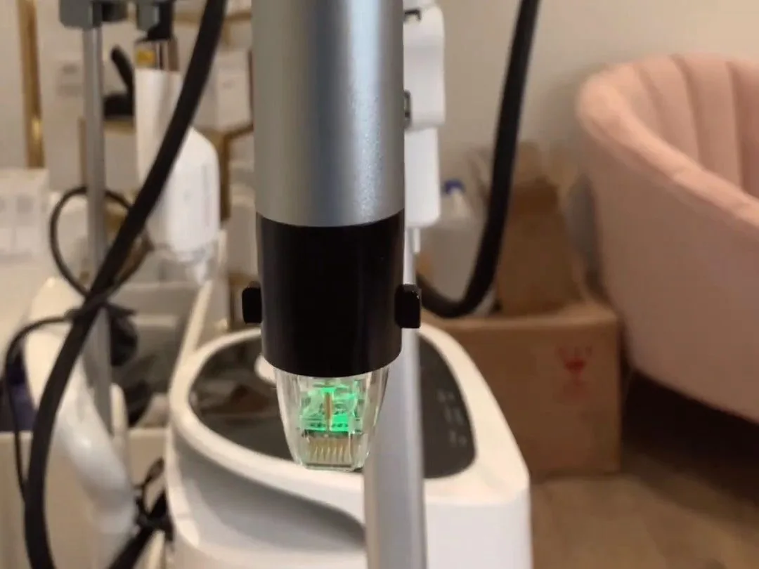 Cicatrices d&rsquo;acné : laser LaseMD ou Genius RF, comment choisir ?