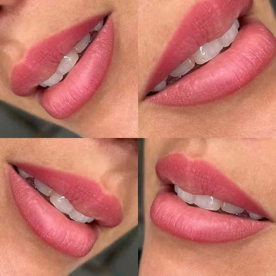 Pigmentation des lèvres