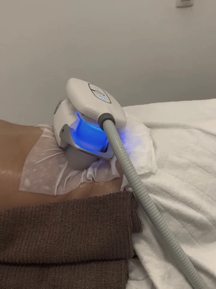 Cryolipolyse Z-Lipo en cabine chez House of Highline
