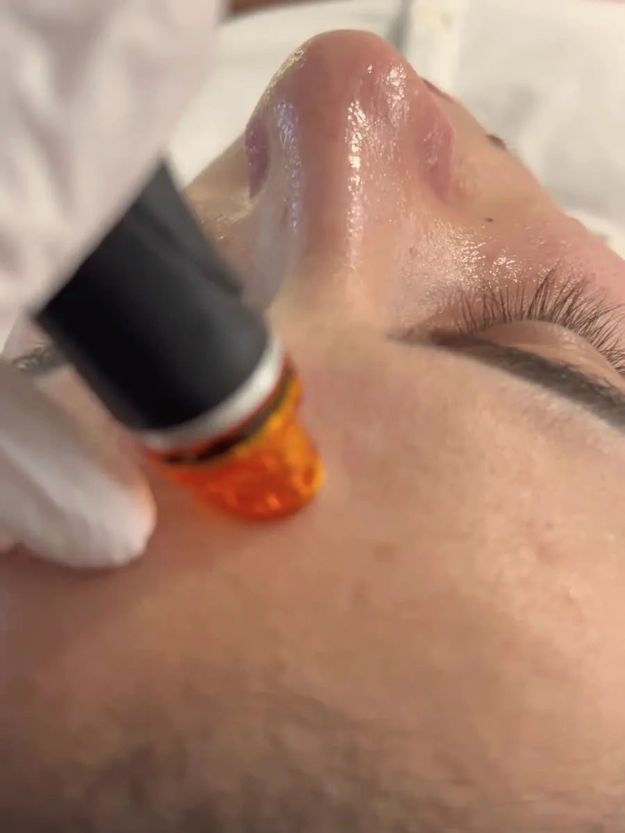 HydraFacial en cabine chez House of Highline